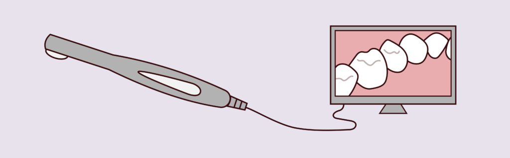 Intraoral Camera Technology Matias Dental Group Dreamscape Imagery 04 Matias Dental Group
