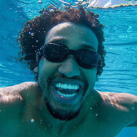 Can Swimming Impact Oral Health? Matias Dental Group swimming and teeth 2025 543 Matias Dental Group